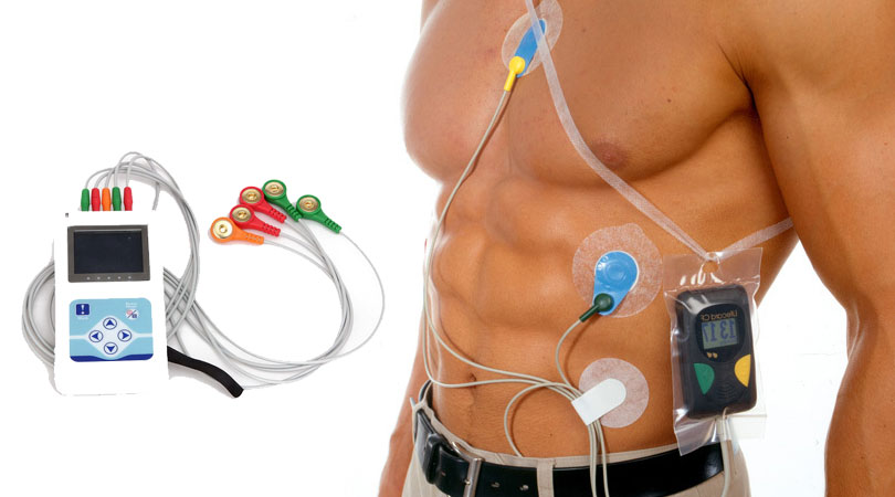 24-hour Holter monitoring: Uses, results, and what to expect